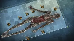 Cold cases de l'Antiquité  Les secrets des morts